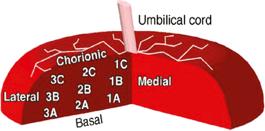 Figure 1: Locations of sampling sites 1A–3C within the placenta.A=mean of 1A, 2A, 3A; B=mean of 1B, 2B, 3B; C=mean of 1C, 2C, 3C. 1=mean of 1C, 1B, 1A; 2=mean of 2C, 2B, 2A; 3=mean of 3C, 3B, 3A. Original artwork by Wyatt et al. [11] reproduced with permission.