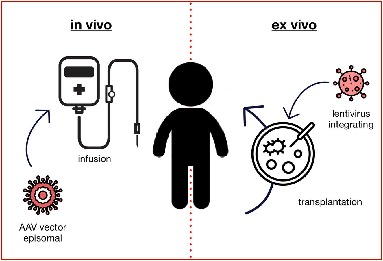 Figure 1:
Gene augmentation therapy. The in vivo approach typically uses adeno-associated virus (AAV) based vectors to transduce the target cells with a fully functional copy of the mutated gene, which is not integrated into the genome but remains in the nucleus as an episome. Ex vivo gene augmentation therapy refers to the process of removing specific cells from the body (e.g. hematopoietic stem cells), which are genetically altered outside the body and then transplanted back into the patient. Lentiviral vectors typically integrate the genetic information into the genome, so that it is passed to all daughter cells.