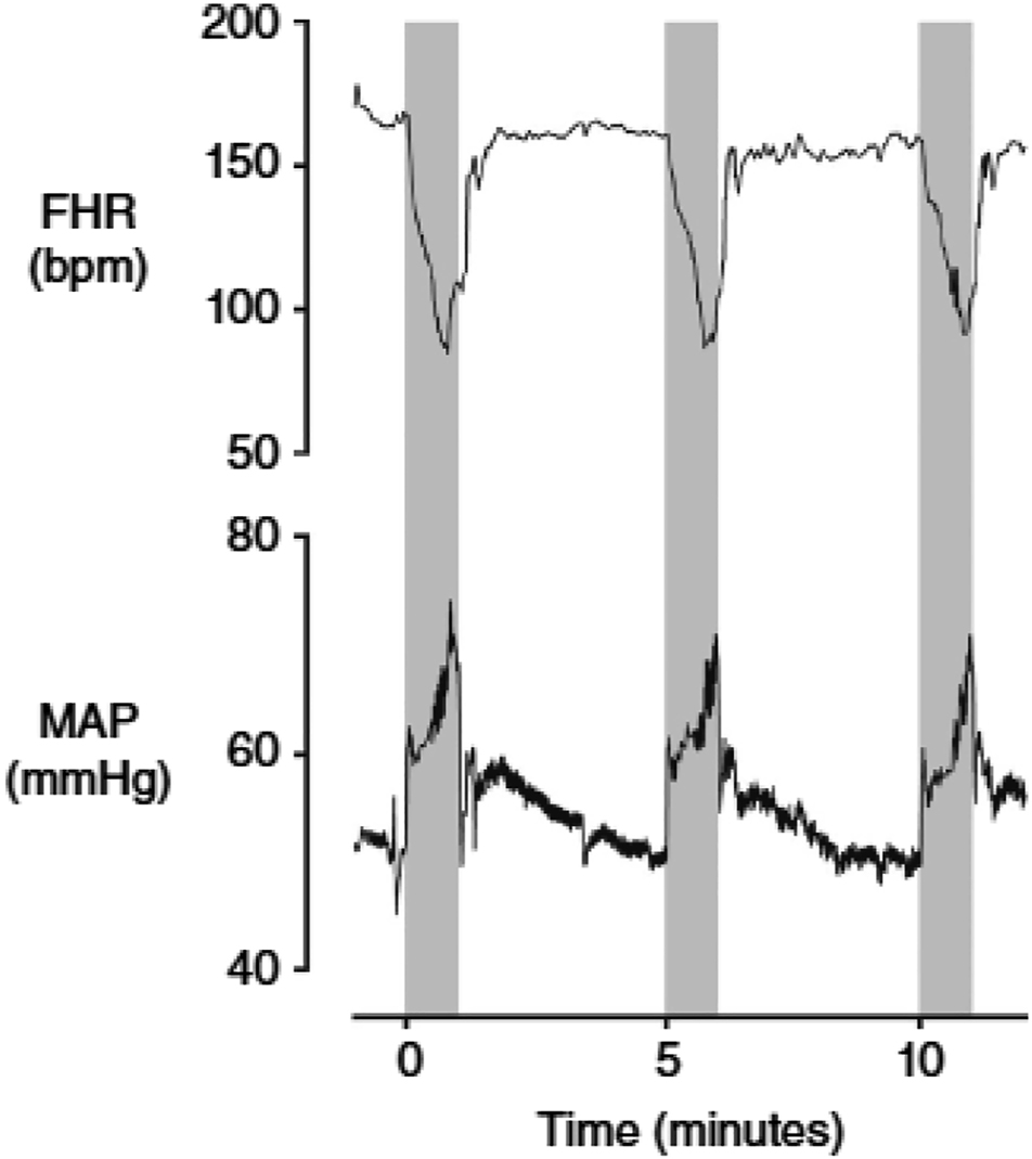 Figure 1: 
Fetal heart rate (FHR, beats min–1 (bpm)) and mean arterial pressure (MAP, mmHg) during three successive 1 min complete umbilical cord occlusions, repeated every 5 min in a near-term fetal sheep (0.85 of gestation). The periods of occlusion are shown in grey. Additionally the release of occlusion is not associated with the development of hypotension below baseline levels. The first occlusion shown here is the 18th in a series of 49 occlusions; at this time arterial pH was 7.358, with a lactate of 1.6 mmol l–1. Data are 1 s averages. Source: Lear CA, Galinsky R, Wassink G, Yamaguchi K, Davidson JO, Westgate JA. et al. The myths and physiology surrounding intrapartum decelerations: the critical role of the peripheral chemoreflex. J Physiol 2016;594:4711–25.

