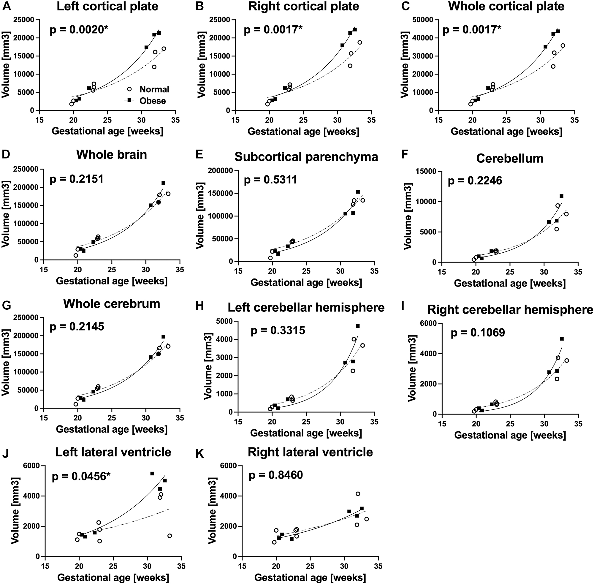 Figure 2: 
Comparison of regional brain volume between the normal BMI group (○, n=8) and obese group (■, n=6). The fetuses in the OB group showed significantly larger left cortical plate, right cortical plate, and whole cortical plate in the late pregnancy (after 28 weeks) (A–C). Additionally, the fetuses in the OB group had larger left lateral ventricles (J).
