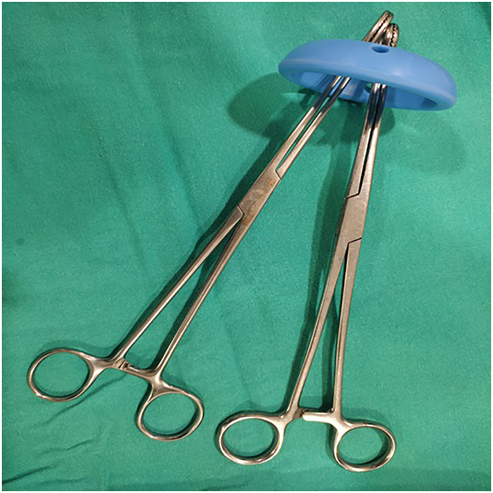 Figure 1: 
Two ring forceps are inserted through the pessary ring with the curvature of the pessary facing upwards.
