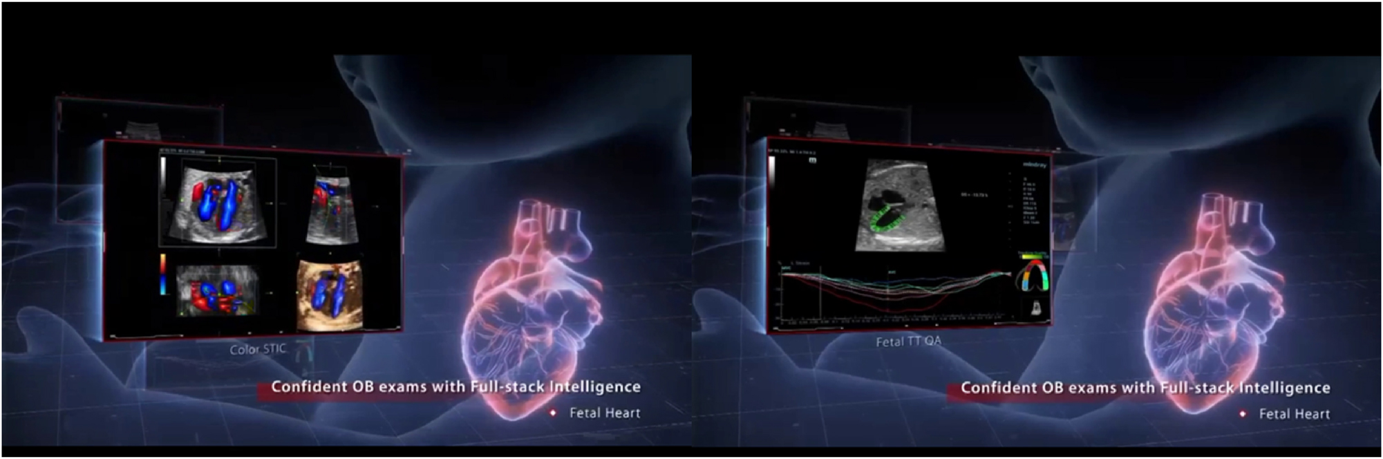 Figure 4: 
This figure illustrates the integration of AI-driven holographic imaging for detailed fetal heart assessment, showcasing the system’s ability to create dynamic, real-time 3D visualizations. On the left, various ultrasound perspectives highlight anatomical and blood flow assessments, while on the right, advanced cardiac metrics and diagnostic overlays demonstrate comprehensive functional analysis. The central holographic representation of the fetal heart is enhanced with color Doppler data, allowing clinicians to observe critical flow patterns. By combining volumetric holography with real-time diagnostic intelligence, this technology supports confident, accurate assessments of fetal cardiac health. It not only enhances clinical decision-making but also facilitates better patient understanding during consultations about congenital heart anomalies or other conditions.