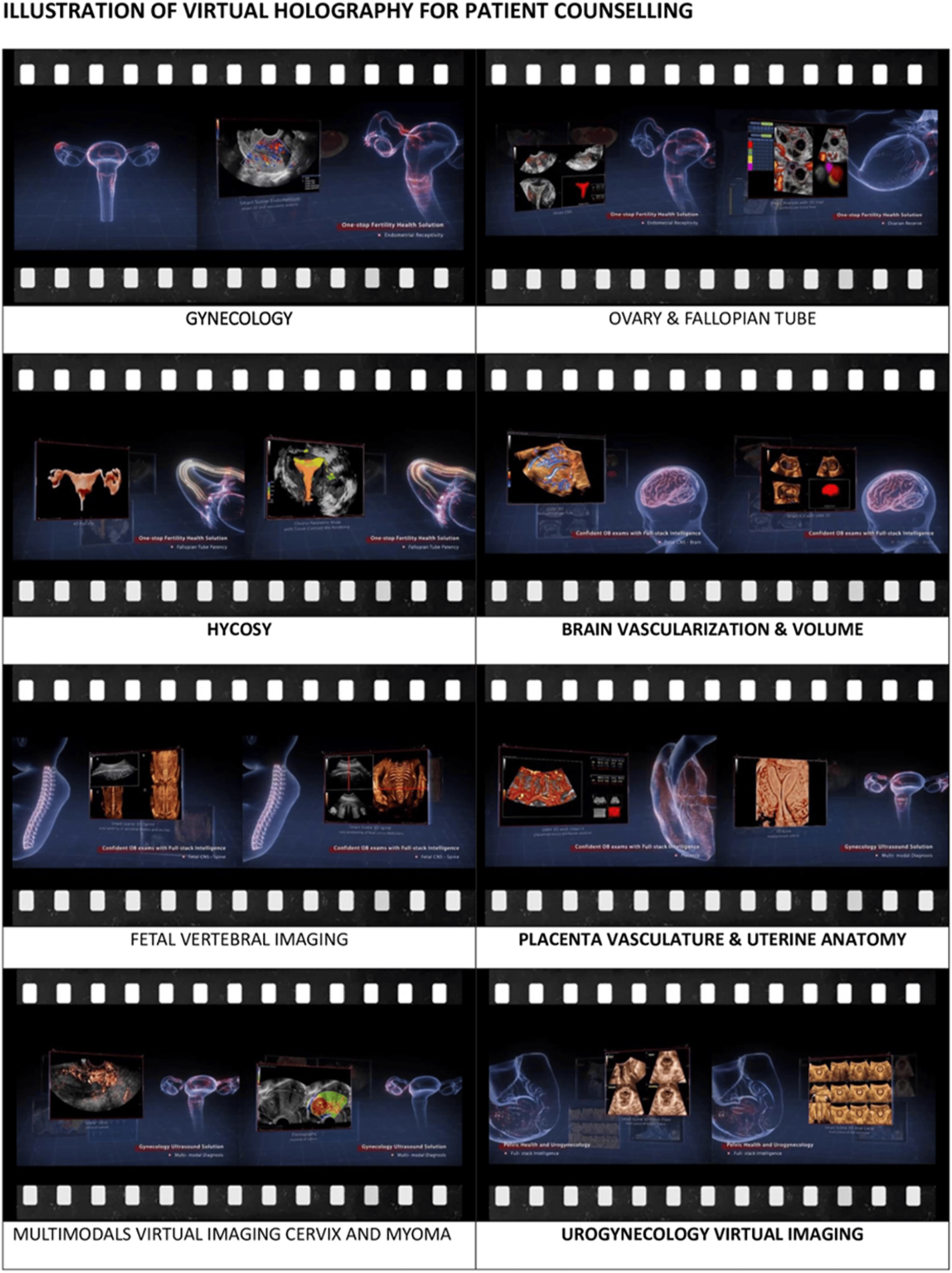 Teaser image from the article