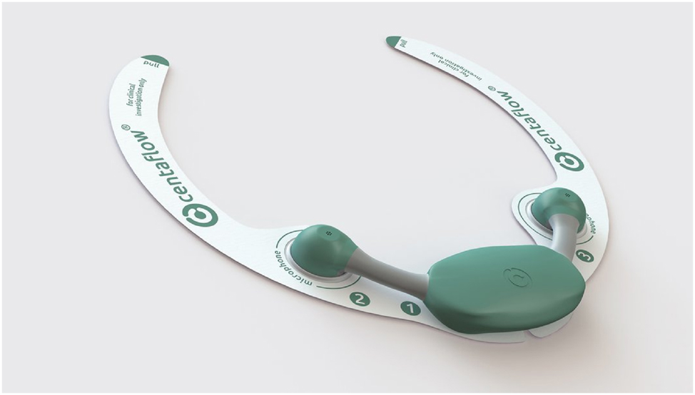 Teaser image from the article