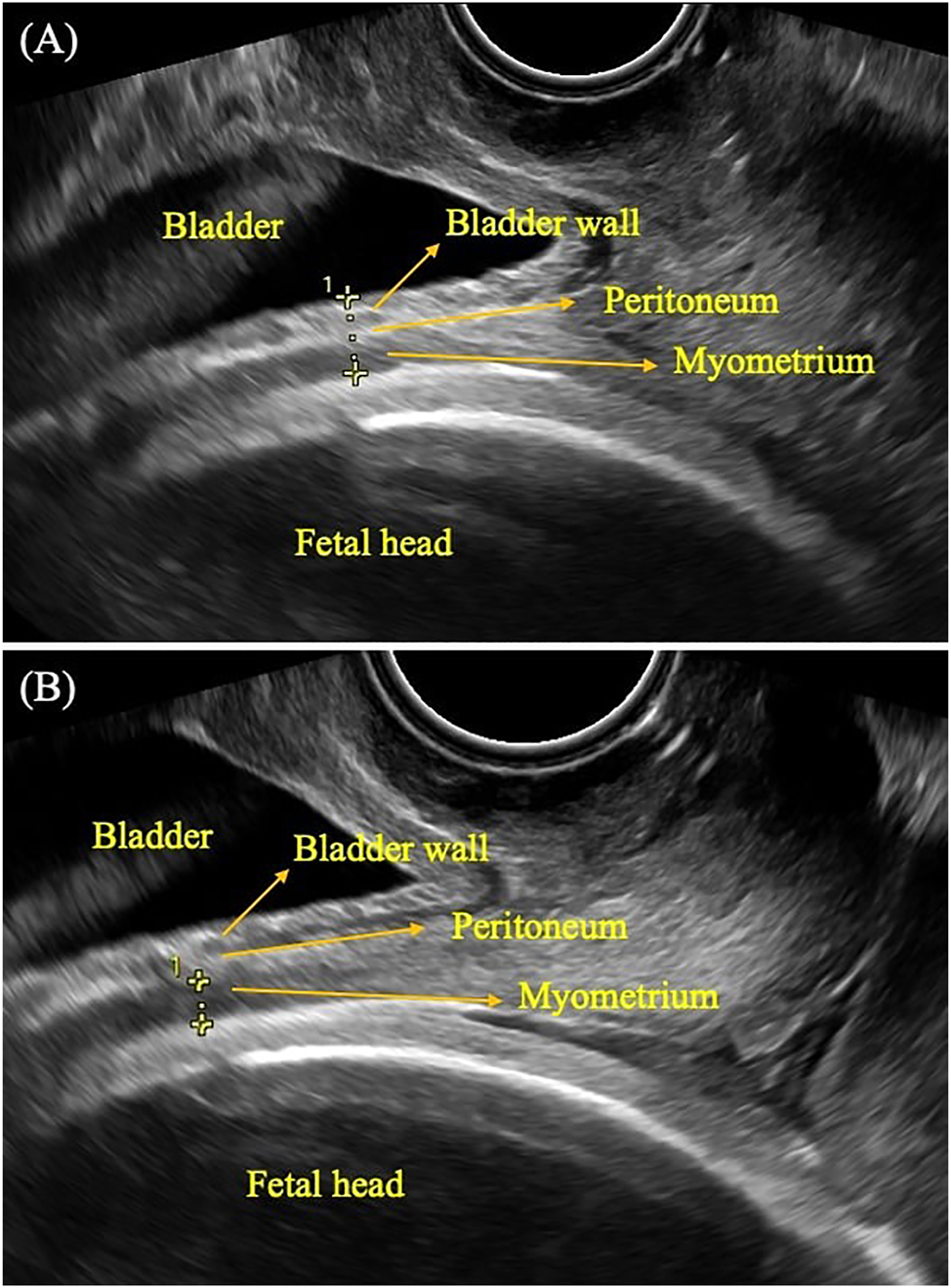 Teaser image from the article