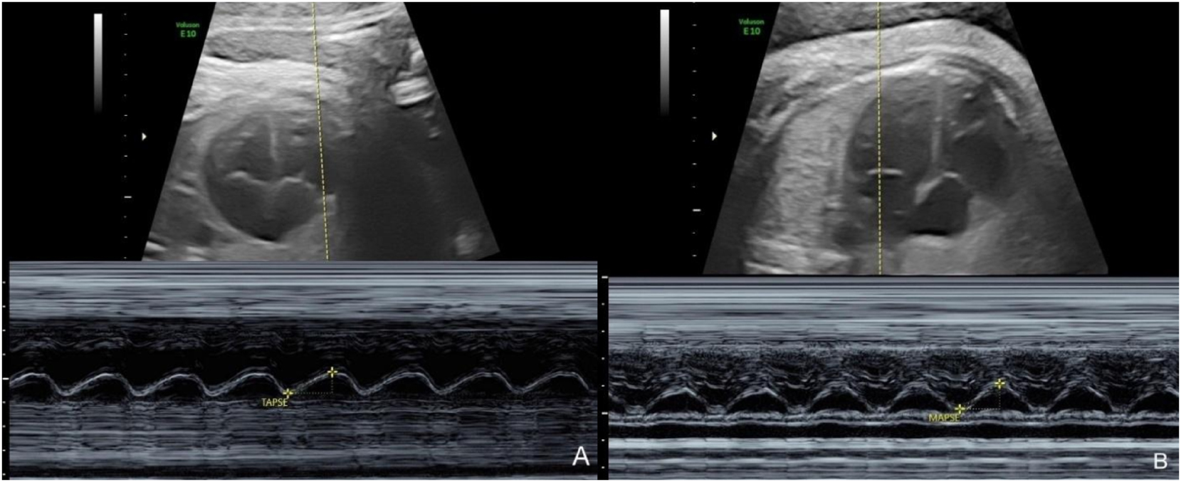 Teaser image from the article