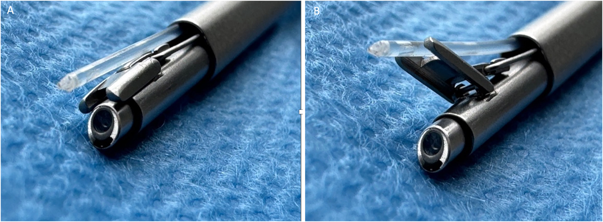 Figure 2: 
Distal tip of a 30° fetoscope with Albarran steering lever. (A) Laser fiber in resting position. (B) Laser fiber in deflected position.