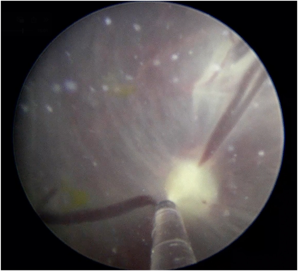 Teaser image from the article