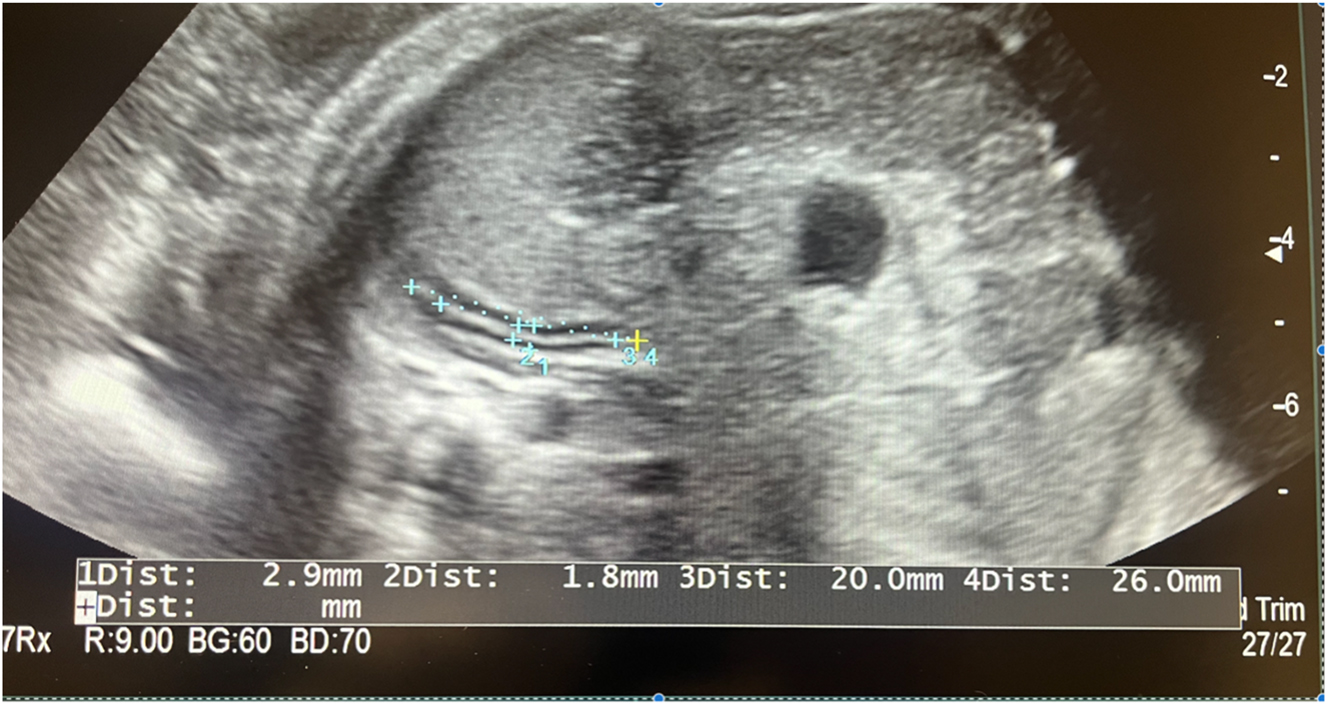 Teaser image from the article