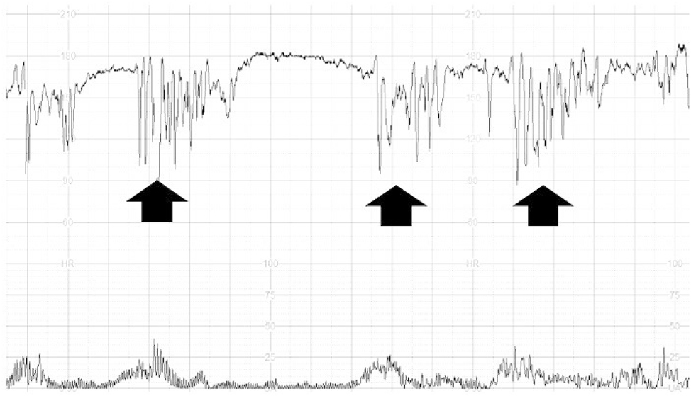 Teaser image from the article