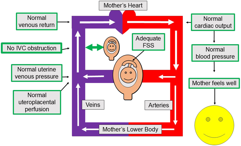 Figure 1: 
Fetal, placental and myometrial perfusion with an unobstructed inferior vena cava. This Figure shows how an unobstructed IVC allows for adequate current fetal, placental and myometrial oxygenation, as well as future placental growth. Specifically, maternal venous return and cardiac output are adequate, uterine venous and intervillous space pressures are low and uteroplacental perfusion and oxygenation are adequate. These favorable conditions allow for current oxygen needs, while vigorous but non-violent flow shear stress within and around the chorionic villi encourages the placenta to grow to serve the fetus’ future needs. IVC, inferior vena cava; FSS, flow shear stress.