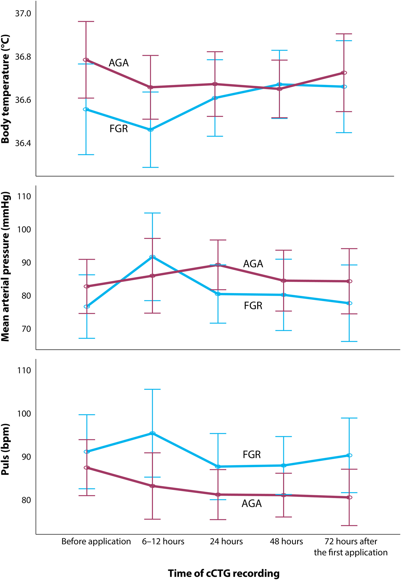 Figure 1: 
Maternal biometric measurements during the time of cCTG (computerized cardiotocogram) recording in the group of growth restricted (FGR) and appropriate-for-gestational age (AGA) fetuses considering betamethasone application.