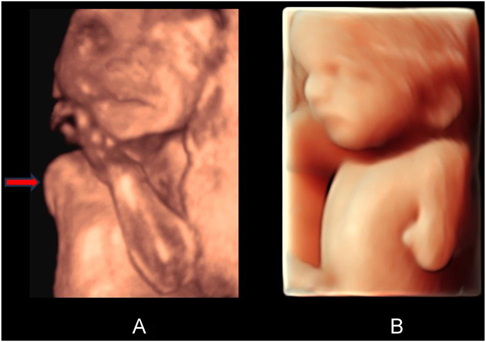 Teaser image from the article