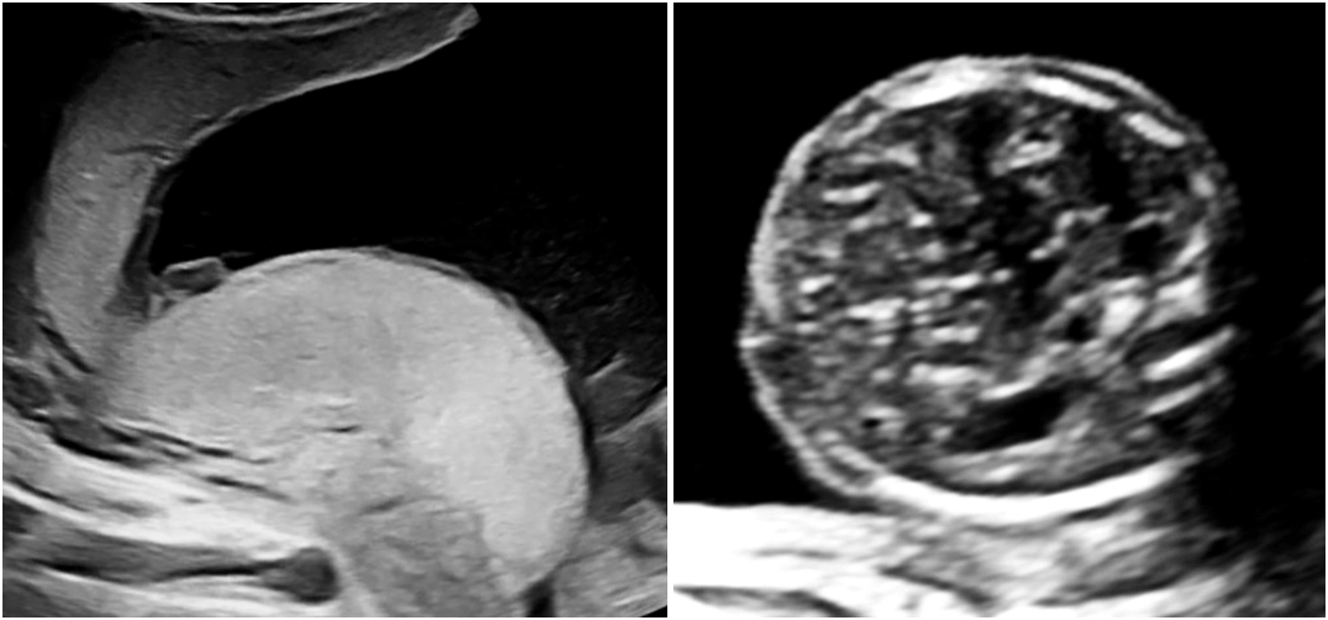 Teaser image from the article