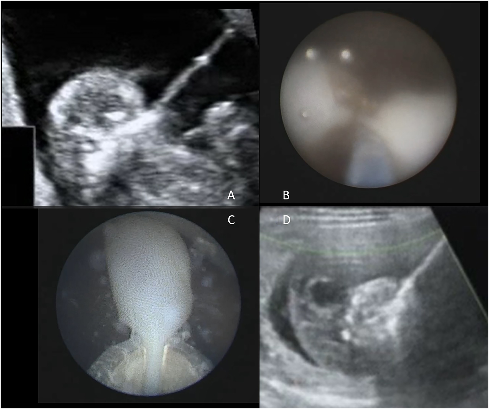 Teaser image from the article