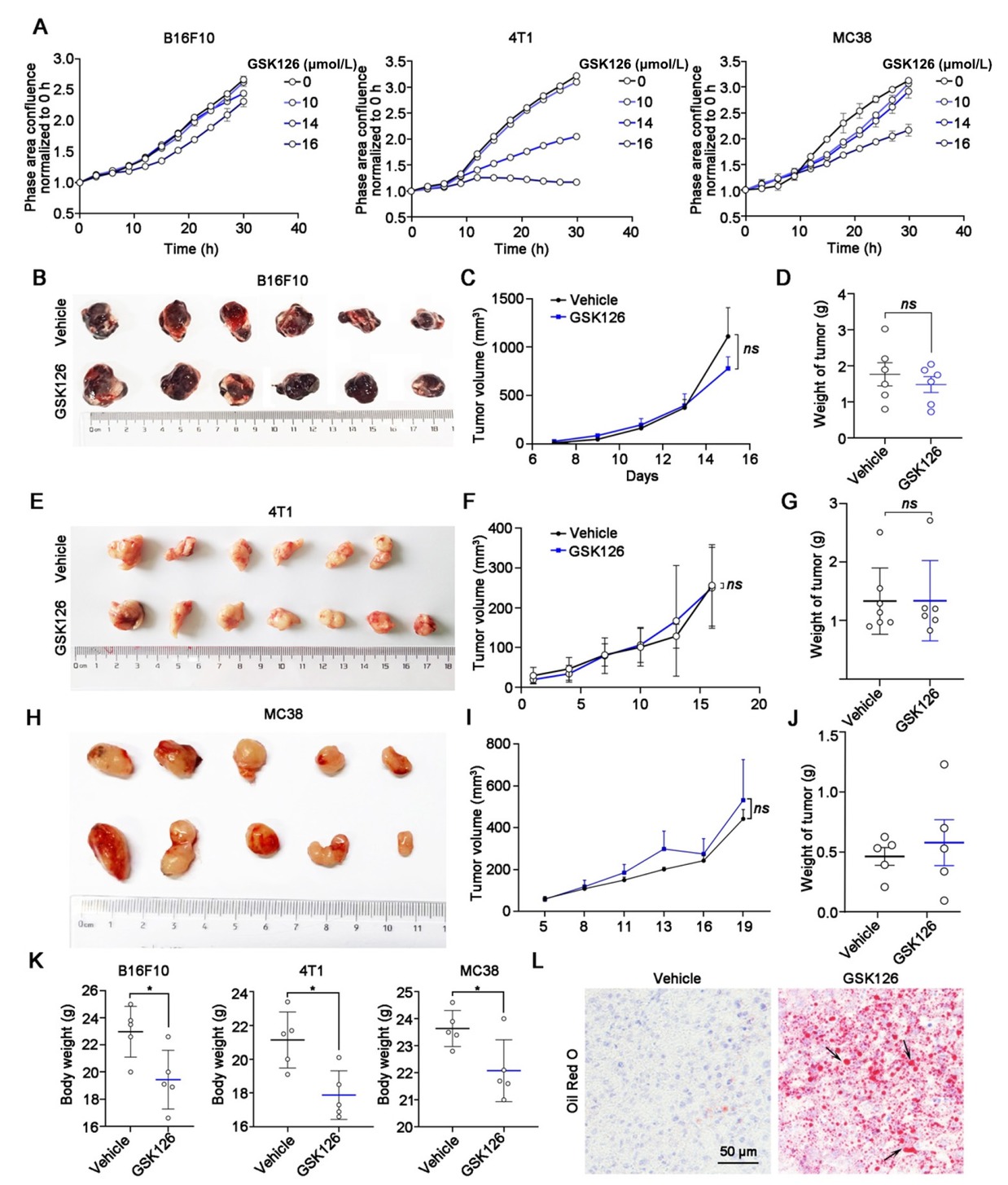 Figure 1 Efficacy of EZH2 inhibitor GSK126 in solid tumors. (A) Cell proliferation of B16F10, 4T1 and MC38 cells in GSK126 (10-16 μmol/L) treatment monitored by IncuCyte S3. Mean ± SEM is shown (n = 6). (B) Images, (C) tumor growth curve, and (D) tumor weight of mice bearing B16F10 in the vehicle group (n = 6) and GSK126 (50 mg/kg) treatment group (n = 6). (E) Images, (F) tumor growth curve, and (G) tumor weight of mice carrying 4T1 in the vehicle group (n = 6) and GSK126 (50 mg/kg) treatment group (n = 7). (H) Images, (I) tumor growth curve, and (J) tumor weight of mice carrying MC38 in the vehicle group (n = 5) and GSK126 (50 mg/kg) treatment group (n = 5). Tumor volume was measured with a vernier caliper every 2–3 days. Tumor volume = Length × Width × Width / 2. Tumor weights were measured at day 15. (K) Body weight of B16F10, 4T1, and MC38 xenograft mice. (L) Oil Red O staining of liver sections in B16F10 tumor-bearing mice of Vehicle and GSK126 treatment group. Data in (D), (G) and (J) were analyzed by one-way ANOVA with Tukey multiple comparison posttest. ns, nonsignificant, *P < 0.05.