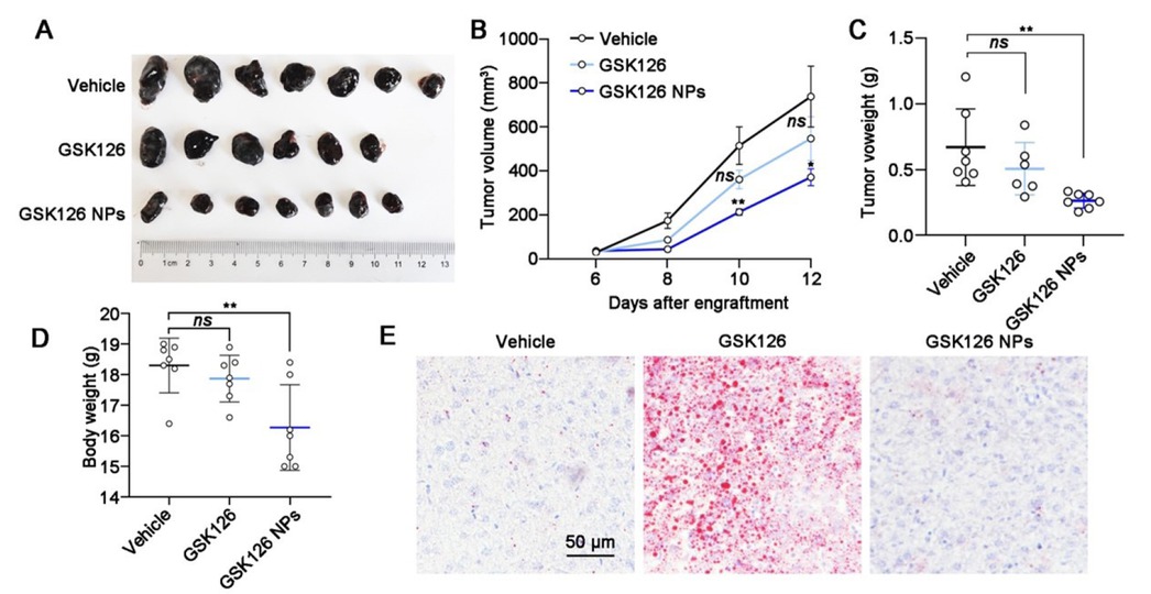 Figure 4 Effects of GSK126 NPs on reducing side effects and increasing efficacy. (A) Images, (B) tumor growth curve, (C) tumor weight, (D) body weight and (E) Oil Red O staining of liver sections of mice carrying B16F10 in the control group (n = 7), GSK126 (50 mg/kg) treatment group (n = 7) and GSK126 NPs (50 mg/kg) treatment group (n = 7). Tumor volume was measured with a vernier caliper every 2 days. Tumor volume = Length × Width× Width / 2. Tumor weights were measured at day 12 after engraftment. Data were analyzed by one-way ANOVA with Tukey multiple comparison posttest. ns, nonsignificant, *P < 0.05, **P < 0.01.