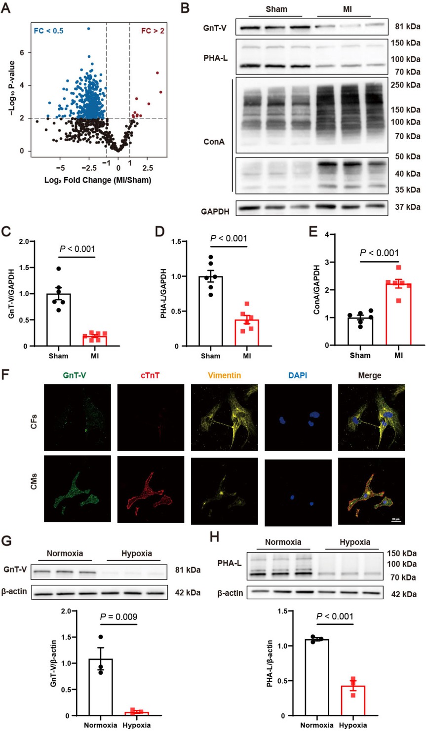 Figure 1 Protein N-glycosylations were reduced and N-acetylglucosaminyltransferase V (GnT-V) expression was suppressed in myocardial infarction (MI). (A) Alterations in the N-glycosylation profile following MI (n = 6 in Sham group, n = 5 in MI group). (B) Representative images and (C–E) quantitative results of the protein expression, products (PHA-L) and substrates (ConA) of GnT-V in MI mice (n = 6). (F) Representative immunofluorescence images of GnT-V (green), cardiac Troponin T (cTnT)(red), and vimentin (yellow) in primary cardiac fibroblasts (CFs) and cardiomyocytes (CMs). The nucleus was stained with DAPI (blue, 1: 5000). Scale bar = 20 μm. (G) Representative western blot images and quantitative results of GnT-V expression in cardiomyocytes exposed to hypoxia (n = 3). (H) Representative lectin blot images and quantitative results of β1, 6-GlcNAc branched structure in cardiomyocytes exposed to hypoxia (n = 3). The results are presented as mean ± SEM. Two-tailed student’s t-test.