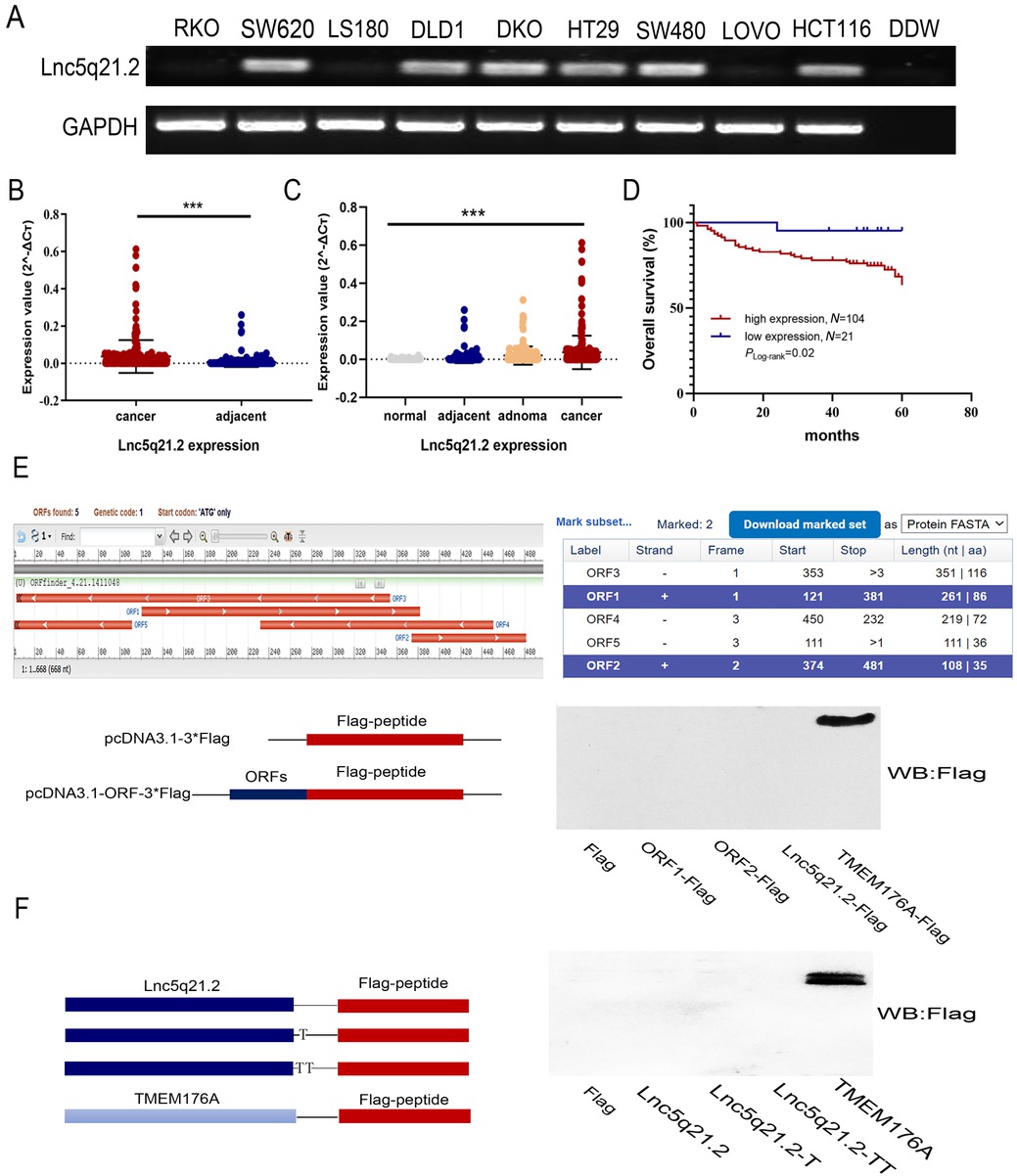 Figure 1 The expression of Lnc5q21.2 in CRC. A: Semi-quantitative RT-PCR shows the expression of Lnc5q21.2 in CRC cells. DDW: double distilled water; GAPDH, internal control. B: The expression of Lnc5q21.2 in normal colorectal mucosa, adenoma, CRC and adjacent tissue samples. normal: normal colorectal mucosa; adjacent: adjacent tissue samples; adenoma: colonic adenoma samples; cancer: CRC samples. C: The expression of Lnc5q21.2 in CRC and adjacent tissue samples.D: The association of Lnc5q21.2 and 5-year OS of CRC. E: The potential predicted ORFs was presented by ORF Finder. ORF1, 121-381bp; ORF2, 374-481bp, ORF3, 353-3bp, ORF4, 450-232bp, ORF5, 111-1bp; +, forward; -, reverse. TMEM176A with Flag tag severs as a positive control. F: Full-length Lnc5q21.2 was cloned into the eukaryotic expression vector pcDNA3.1 with three possible coding patterns. TMEM176A with Flag tag severs as a positive control. ***P < 0.001. CRC, colorectal cancer; RT-PCT, reverse transcription polymerase chain reaction; OS, overall survival.