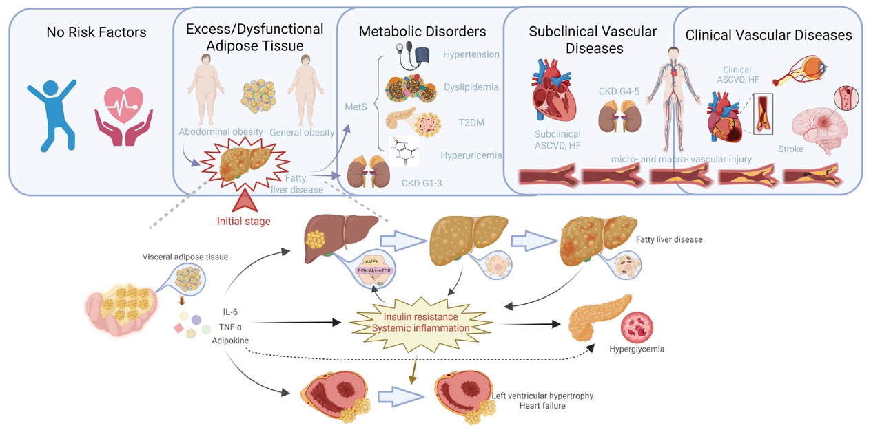 Figure 1 Liver adipose deposition in the framework of liver-metabolic-vascular syndrome. The deposition of adipose tissue in subcutaneous and ectopic sites leads to overall and abdominal obesity. Visceral adipose deposition further contributes to the development of fatty liver disease and metabolic disorders such as metabolic syndrome. This process sets off a vicious cycle that ultimately results in vascular dysfunction throughout the body, not just in the cardio-renal system, but also including peripheral artery disease in the limbs, intracranial vascular lesions, and cognitive dysfunction related to the central nervous system. LMV: liver-metabolic-vascular syndrome; T2DM: type 2 diabetes; CKD: chronic kidney disease; ASCVD: atherosclerotic cardiovascular disease; HF: heart failure; IL-6: interleukin-6; TNF-α: tumor necrosis factor-α.