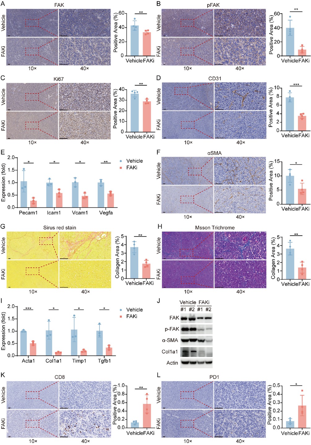 Figure 4 FAK Inhibition reprograms tumor microenvironment via suppressing proliferation, angiogenesis, and restoring anti-tumor immunity. (A-D) Representative IHC images and quantification of area performed by FAK (A), phospho-FAK (B), Ki67 (C), CD31 (D) immunohistochemistry on liver tumor tissues of mice treated with vehicle or FAK inhibitor. (E) qPCR was used to evaluate the expression of angiogenesis-associated markers (Pecam1, Icam1, Vcam1, Vegfa). (F) Representative IHC images and quantification of area performed by α-SMA immunohistochemistry on liver tumor tissues of mice treated with vehicle or FAK inhibitor. (G-H) Representative images and quantification of collagen area performed by Sirius red staining (G) and Masson staining (H) on liver tumor tissues of mice after treatment. (I) qPCR was used to evaluate the expression of fibrosis-related genes (Acta2, Col1a1, Tgfb1, Timp1). (J) Western blots of FAK, p-FAK, α-SMA, and Col1a1 expression in the orthotopic liver tumor tissues after treatment. (K-L) Representative IHC images and quantification of area performed by CD8 (K) and PD-1 (L). Scale bar: 100 μm. Results in each group were presented as mean ± SEM. *P < 0.05, **P < 0.01, ***P < 0.001. FAK: focal adhesion kinase; SEM: standard error of mean.