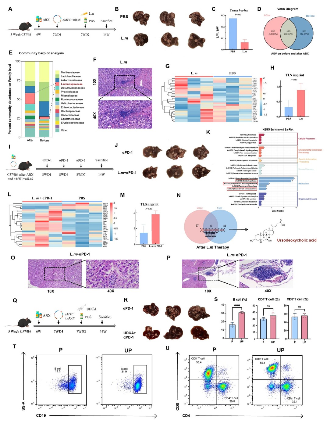 Figure (A) Schematic of the establishment of a primary HCC model in C57/BL6 mice. (B) Macroscopic view of tumors post-L.m treatment. (C) Tumor burden following L.m treatment. (D) Venn diagram depicting distinct microbiota composition between pre- and post-treatment groups. (E) Differential microbiota enrichment analysis identifies Lachnospiraceae as the most significantly enriched taxon. (F) Representative histology post-L.m treatment, showing an immature tertiary lymphoid structure. (G, H) Bulk RNA-seq of liver tissue post- L.m treatment shows an elevated TLS signature score. (I) Schematic of the αPD-1 treatment regimen. (J) Macroscopic view of tumors post-combination therapy with L.m and αPD-1, indicating an enhanced immunotherapy response. (K) Untargeted metabolomics post- L.m treatment reveals enrichment of the secondary bile acid biosynthesis pathway. (L, M) Bulk RNA-seq of liver tissue post-combination therapy with L.m and αPD-1 shows a further increased TLS signature score. (N) UDCA as a key metabolite significantly elevated in both liver and blood post-L.m treatment. (O, P) Representative histology post-combination therapy with αPD-1 or L.m and αPD-1, showing (O) an immature and (P) a mature tertiary lymphoid structure. (Q) Schematic of the UDCA treatment regimen. (R) Macroscopic view of tumors post-combination therapy with UDCA and αPD-1. (S) Quantification of liver-infiltrating immune cells by flow cytometry post-combination therapy with UDCA and αPD-1. (T, U) Representative flow cytometry plots post-combination therapy with UDCA and αPD-1.