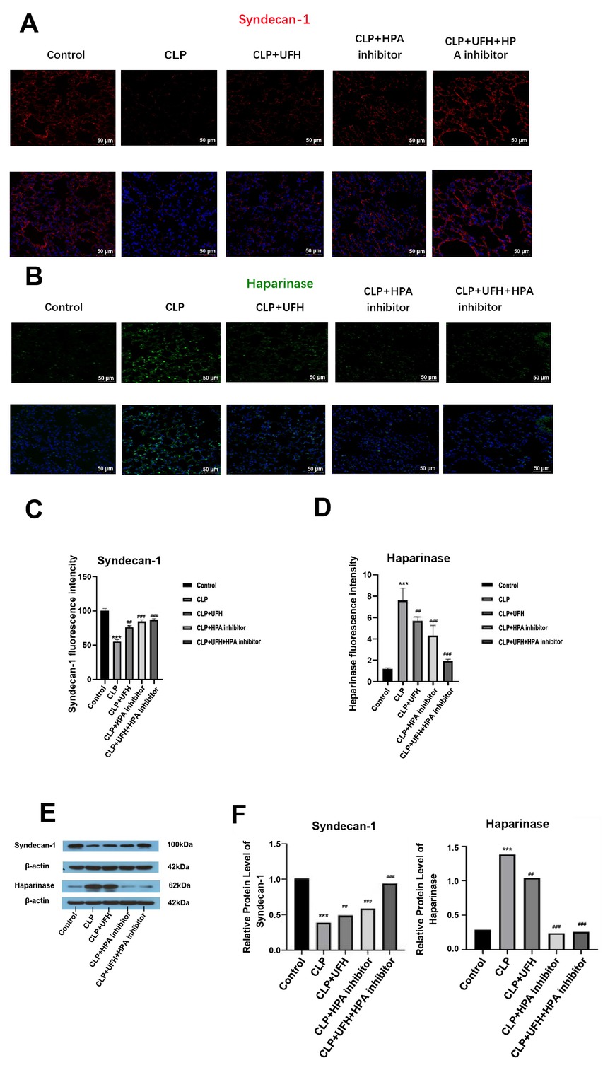 Figure 1 Expressions of syndecan-1 and heparinase in each group (n = 6, 200×). (A-D) Positive expression. Scale bar = 50 μm. (E, F) Relative expression. ***P < 0.001 vs. control group; ##P < 0.01, ###P <0.001 vs. CLP group. UFH, unfractionated heparin; HPA, heparinase. CLP, cecal ligation and puncture.