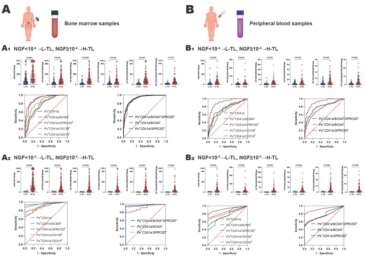 Figure 1 The value of microvesicles in bone marrow and peripheral blood in monitoring MM tumor load. A Bone marrow samples: A1 NGF = 10-4 as the threshold, the number of MM cell-derived microvesicles from bone marrow was significantly higher in H-TL group compared with in L-TL group, and the ROC curves were analyzed Ps+CD41a−, Ps+CD41a−CD138+, Ps+CD41a−BCMA+, Ps+CD41a−CD319+, Ps+CD41a−GPRC5D+, and Ps+CD41a−BCMA+GPRC5D+microvesicles from bone marrow to distinguish the H-TL patients from L-TL patients; A2 NGF = 10-5 as the threshold, the number of MM cell-derived microvesicles from bone marrow was significantly higher in H-TL group compared with in L-TL group, and the ROC curves were analyzed Ps+CD41a−, Ps+CD41a−CD138+, Ps+CD41a−BCMA+, Ps+CD41a−CD319+, Ps+CD41a−GPRC5D+, and Ps+CD41a−BCMA+GPRC5D+microvesicles from bone marrow to distinguish the H-TL patients from L-TL patients. B Peripheral blood samples: B1 NGF=10-4 as the threshold, the number of MM cell-derived microvesicles from peripheral blood was significantly higher in H-TL group compared with in L-TL group, and the ROC curves were analyzed Ps+CD41a−, Ps+CD41a−CD138+, Ps+CD41a−BCMA+, Ps+CD41a−CD319+, Ps+CD41a− GPRC5D+, and Ps+CD41a−BCMA+GPRC5D+microvesicles from peripheral blood to distinguish the H-TL patients from L-TL patients; B2 NGF=10-5 as the threshold, the number of MM cell-derived microvesicles from peripheral blood was significantly higher in H-TL group compared with in L-TL group, and the ROC curves were analyzed Ps+CD41a−, Ps+CD41a−CD138+, Ps+CD41a−BCMA+, Ps+CD41a−CD319+, Ps+CD41a−GPRC5D+, and Ps+CD41a−BCMA+GPRC5D+microvesicles from peripheral blood to distinguish the H-TL patients from L-TL patients. NGF: next-generation flow; L-TL: low tumor load; H-TL: high tumor load; MVs: microvesicles; Ps: phosphatidylserine; AUC: area under the curve.