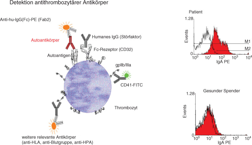 Abbildung 15 Plättchen-assoziiertes Immunglobulin und Antikörper gegen Thrombozyten.