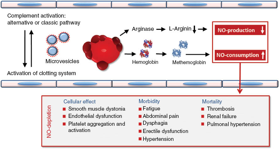 Figure 2: The consequences of intravascular hemolysis (adopted from [49, 50]).Activation of complement via the alternative of classic pathway induce intravascular hemolysis. The erythrocyte releases hemoglobin. This is transformed into methaemoglobin by oxidation with nitric oxide (NO). This process consumes NO. Another ingredient of the erythrocyte is arginase, that catalyzes the formation of L-ornitin by consumption of L-arginine. Arginine is the substrate for the NO-synthase. Thus formation of NO is inhibited. These two processes induce NO-depletion. Microvesicles are generated from lysing erythrocytes, from platelets and endothelial cells (not shown) by complement activation. They are negatively charged because the expression of phosphatitylserine that is normally located in the intracellular side of the membrane bilayer. The binding of tenase and prothrombinase complex to the negatively charged membrane surface is facilitated by Ca2+ (not shown). The activated complement and clotting system can activate each other leading to a circulus vitiosus of thrombotic events in PNH (for more details see the review from Hill et al. [49]).