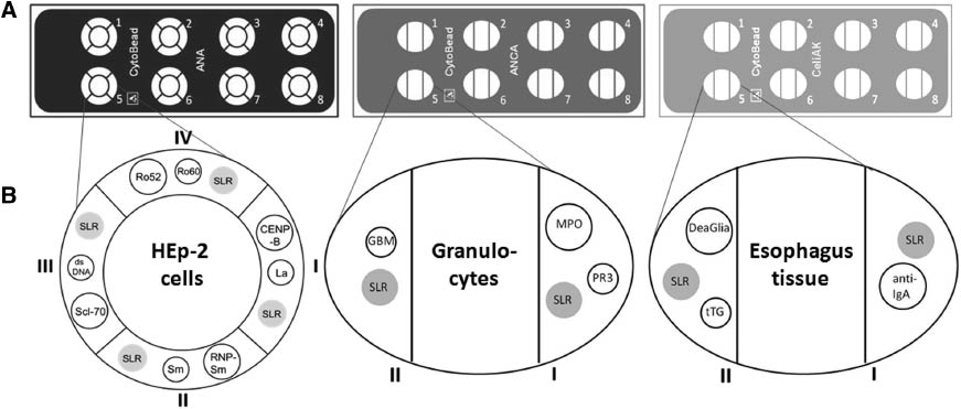 Figure 2: CytoBead slides with eight application points for different test profiles.Combination of screening with native substrate of cells or tissue (center compartment) and artificial substrate through antigen-loaded fluorescent micro-particles (peripheral compartments). CytoBead ANA (left), ANCA (center) and celiac disease (right). SLR is the designation of reference beads for the manual bead classification.