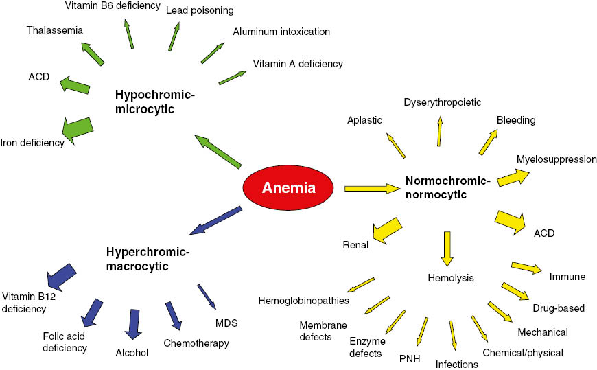 Figure 1: Classification of anemia according to the red cell indices.