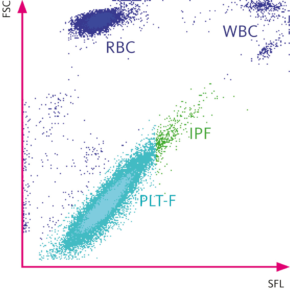 Figure 1: 
Scatterplot of reticulated thrombocyte measurement by Sysmex XN automated hematology analyzer.
Sysmex XN-series determines immature platelet fraction within a dedicated platelet fluorescence assay (PLT-F channel) by forward light scatter vs. sideward fluorescence. FSC, forward scatter; IPF, immature platelet fraction; PLT-F, platelets; RBC, red blood cells; SFL, sideward fluorescence; WBC, white blood cells. Reprinted from Sysmex Europe GmbH with permission.