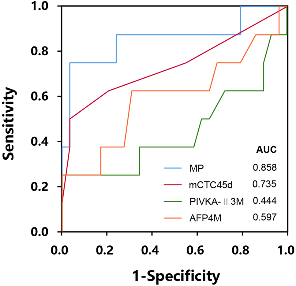 Figure 1: 
Receiver operating characteristic (ROC) curve for efficacy analysis of risk factors in post-LT metastasis in two years.
The variable MP is calculated by the two-ends logistic regression model, based on variables including mesenchymal CTC level at the 45th day (mCTC45d), the AFP level at the fourth month (AFP4M), and the PIVKA-Ⅱ level at the third month (PIVKA-II3M).
