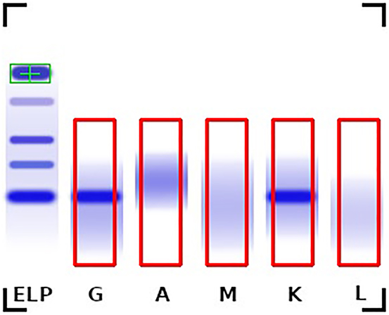 Figure 1: 
Example immunofixation image with the serum albumin reference position (green) and the bounding boxes of the individual lanes (red) shows a monoclonal gammopathy IgG type Kappa.