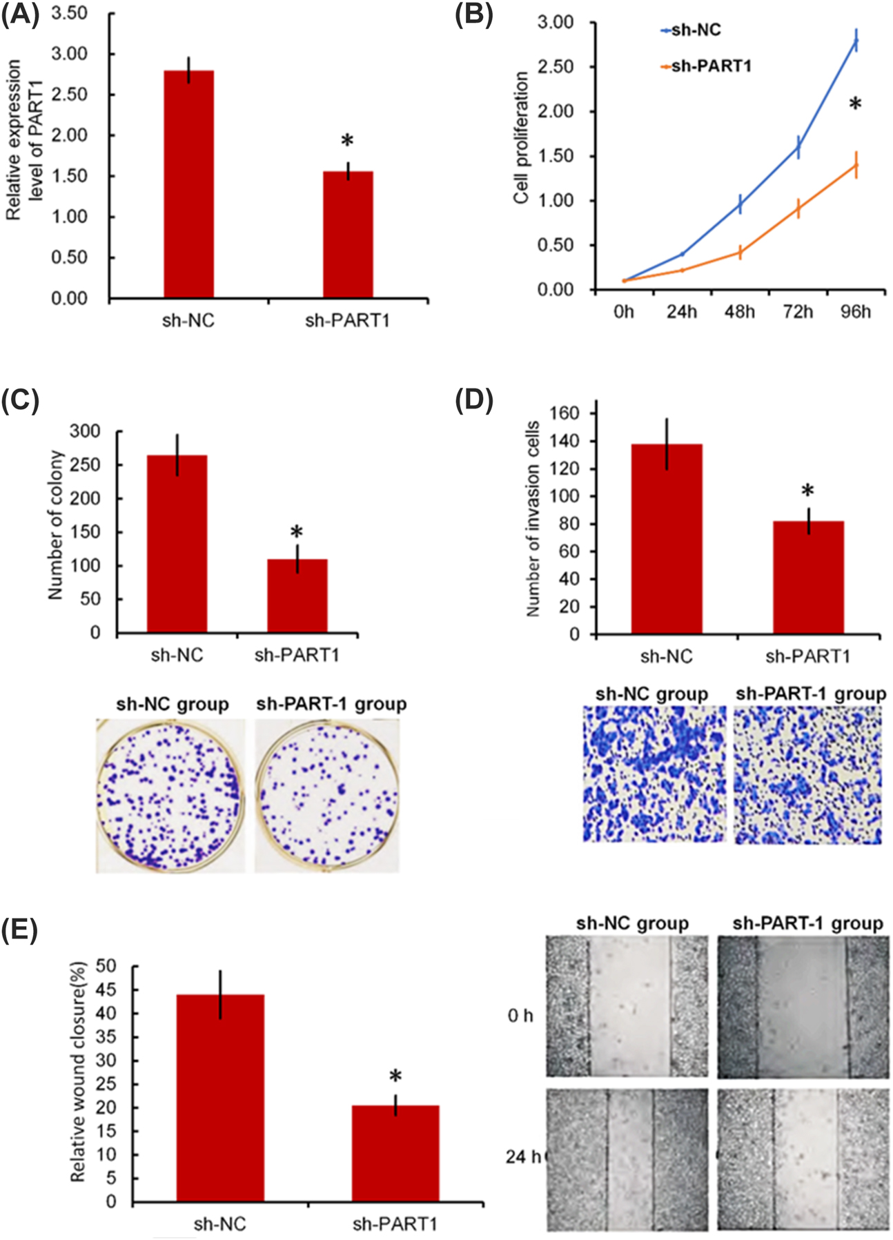 Figure 2: 
The effect of knocking down PART-1 on the proliferation, invasion, and migration of A549 cells. (A) The expression of PART-1 in A549 cells transfected with PART-1 shRNAs and negative control was validated by RT‒qPCR. (B) The proliferation of sh-PART1 and sh-NC cells was determined by the CCK-8 assay. (C) Colony formation of sh-PART1 and sh-NC cells. (D, E) The cell invasion and wound healing results of sh-PART1 and sh-NC cells by Transwell invasion assay and wound healing assay. *p<0.05 sh-PART1 group vs. sh-NC group.
