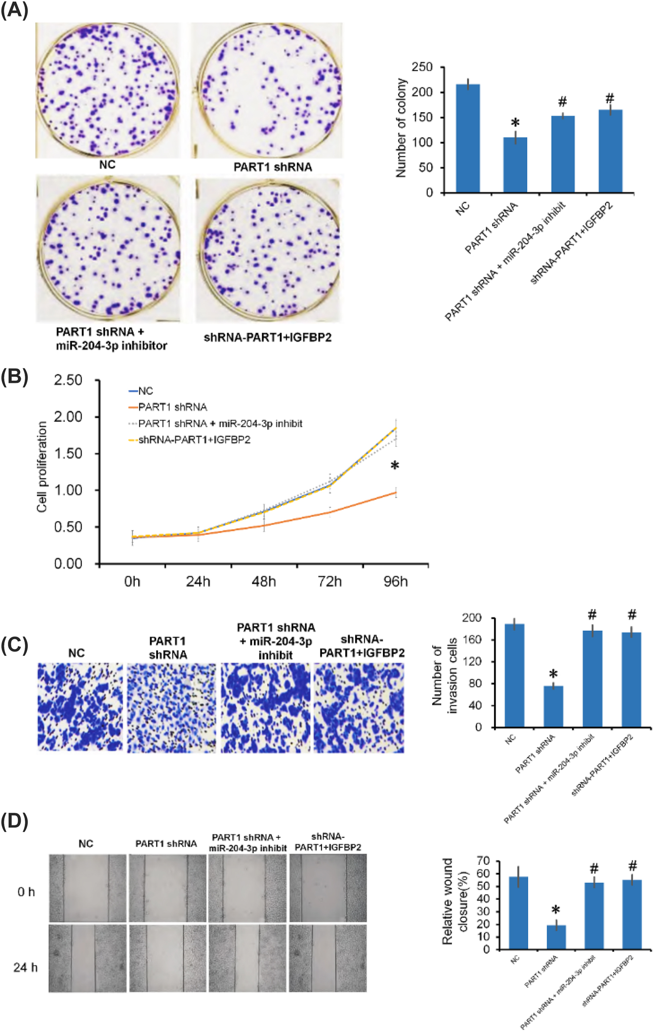 Figure 6: 
The downregulation of PART1 inhibited the proliferation, invasion, and migration of A549 cells by regulating the miR-204-3p-targeted IGFBP-2 pathway. (A) Colony formation of NC, PART1-shRNA, PART1-shRNA + miR204-3p inhibitor, and PART1-shRNA + IGFBP2 cells. (B) Cell proliferation, as determined by CCK-8 assay. (C, D) Cell invasion and wound healing assays of NC, PART1-shRNA, PART1-shRNA + miR204-3p inhibitor, and PART1-shRNA + IGFBP2 cells by Transwell invasion assay and wound healing assay. * *p<0.05, PART1-shRNA group compared with NC group; #p<0.05 compared with PART1-shRNA group.
