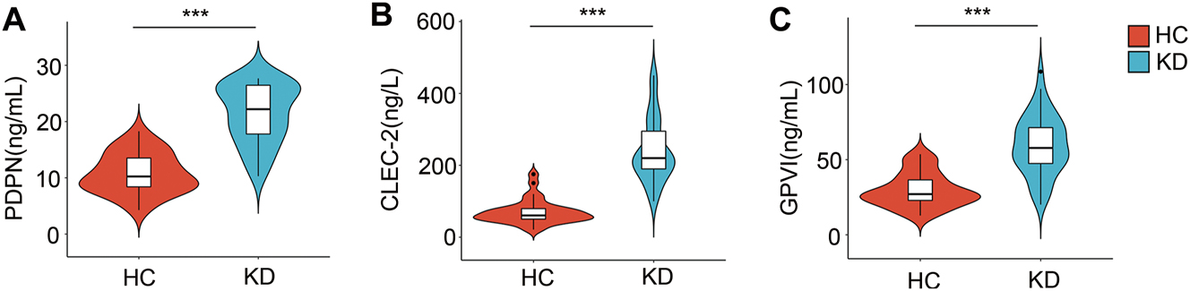 Figure 1: 
The levels of plasma PDPN, CLEC-2 and GPVI in KD and HC. Comparison of PDPN (A), CLEC-2 (B), and GPVI(C) levels in patients with KD and HC. *, p<0.05; **, p<0.01; ***, p<0.001. KD, Kawasaki disease; HC, healthy controls.
