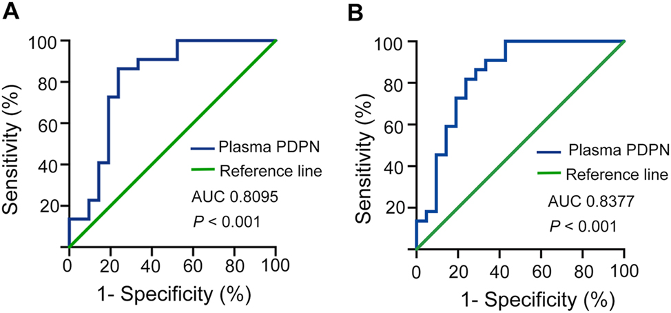Figure 3: 
ROC curves for evaluating the predictive utility of PDPN in patients with KD and distinguishing between patients with CALs and NCALs. *, p<0.05; **, p<0.01; ***, p<0.001. AUC, area under the curve; ROC, receiver operator characteristic; KD, Kawasaki disease; CALs, coronary artery lesions; NCALs, non-CALs.
