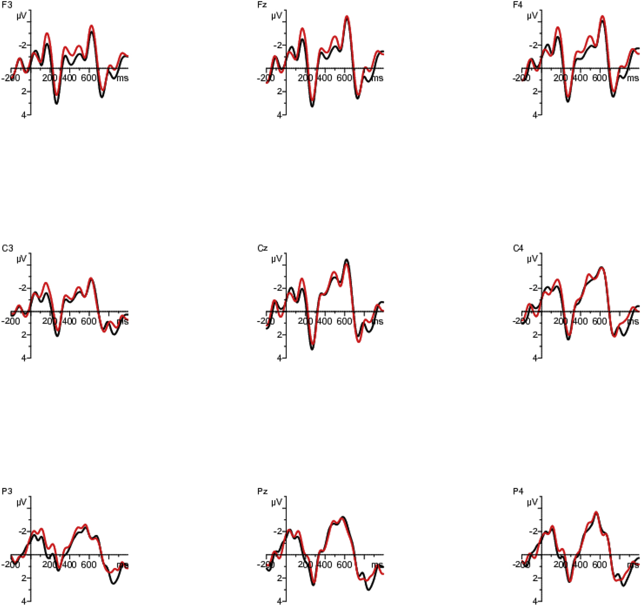 Figure 5: ERP effects on the adjective region (renovierte) following a causal connector at a subset of nine electrodes. Black line: congruent condition; red line: incongruent condition. Negativity is plotted upwards. For presentation purpose only, ERPs were filtered off-line with 10 Hz low pass.