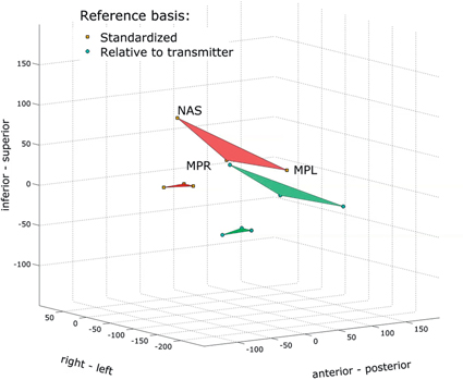 Movie 6 Reference sensors and bite plate sensors before and after standardization. In the standardized reference basis the most anterior bite plate sensor is the origin and the horizontal coordinate axis is parallel to the occlusal plane. Note that horizontal coordinate increases from anterior to posterior.
