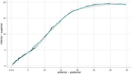 Movie 7 Illustration of a palate trace. The speaker drags a tongue tip sensor from the back of their upper incisors along their palate. Data points from the palate trace are subsequently fit with a smoothing spline (red line).