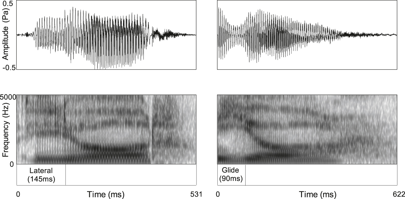 Figure 3: 
Spectrogram and waveform comparison of palatalised lateral versus palatal glide at the start of the word ‘leabhar’.