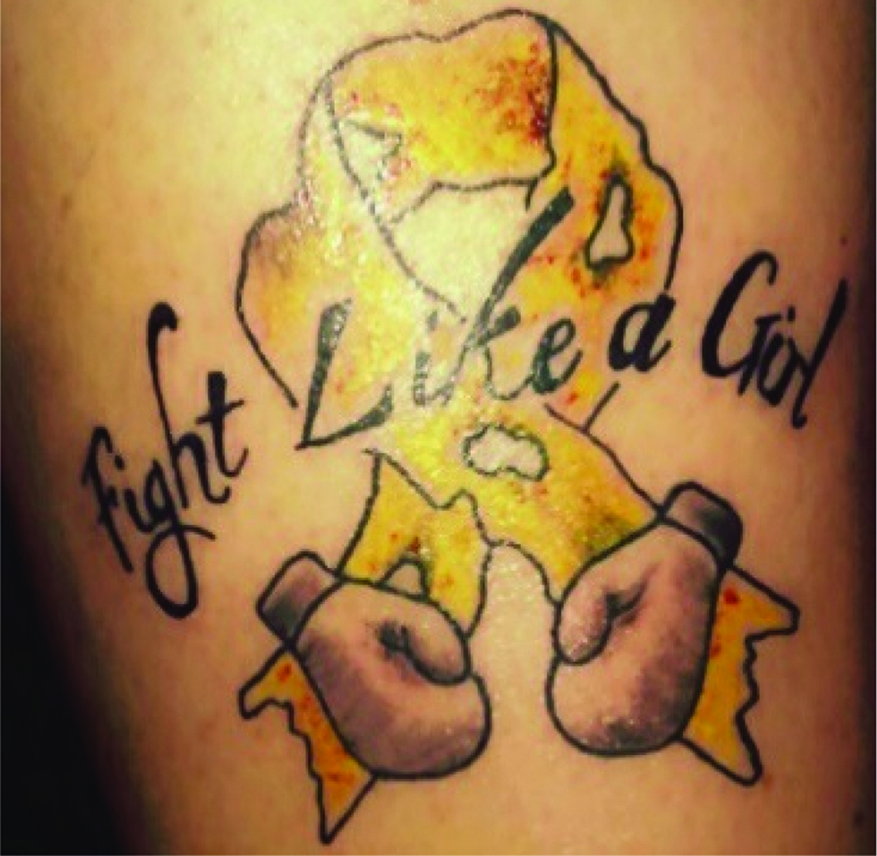 Figure 2: 
            Endometriosis tattoo (ED7).
            https://www.pinterest.com.au/pin/819866307134113683/, accessed 23 November 2017
          