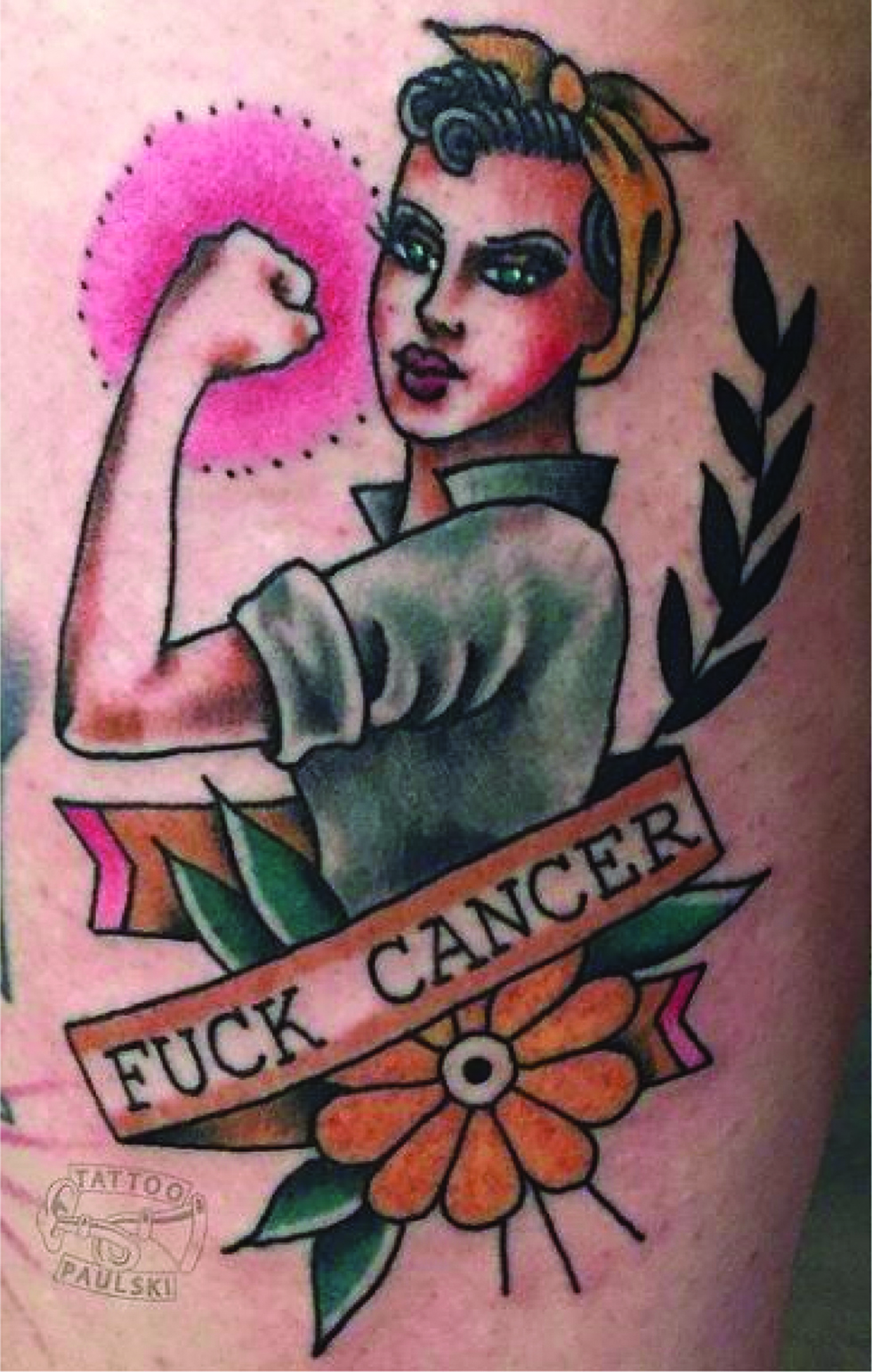 Figure 4: 
            Breast cancer tattoo (BC3).
            https://www.instagram.com/p/BNDCOa_Bvk2/?taken-by=karenlazarovitz_brca, accessed 31 March 2019
          