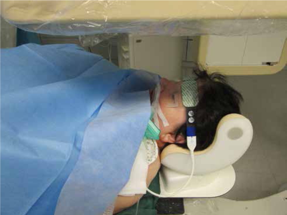 Figure 2 The frequently observed jam-packed anesthesia working place in radiology department; patient monitored with NIRS.