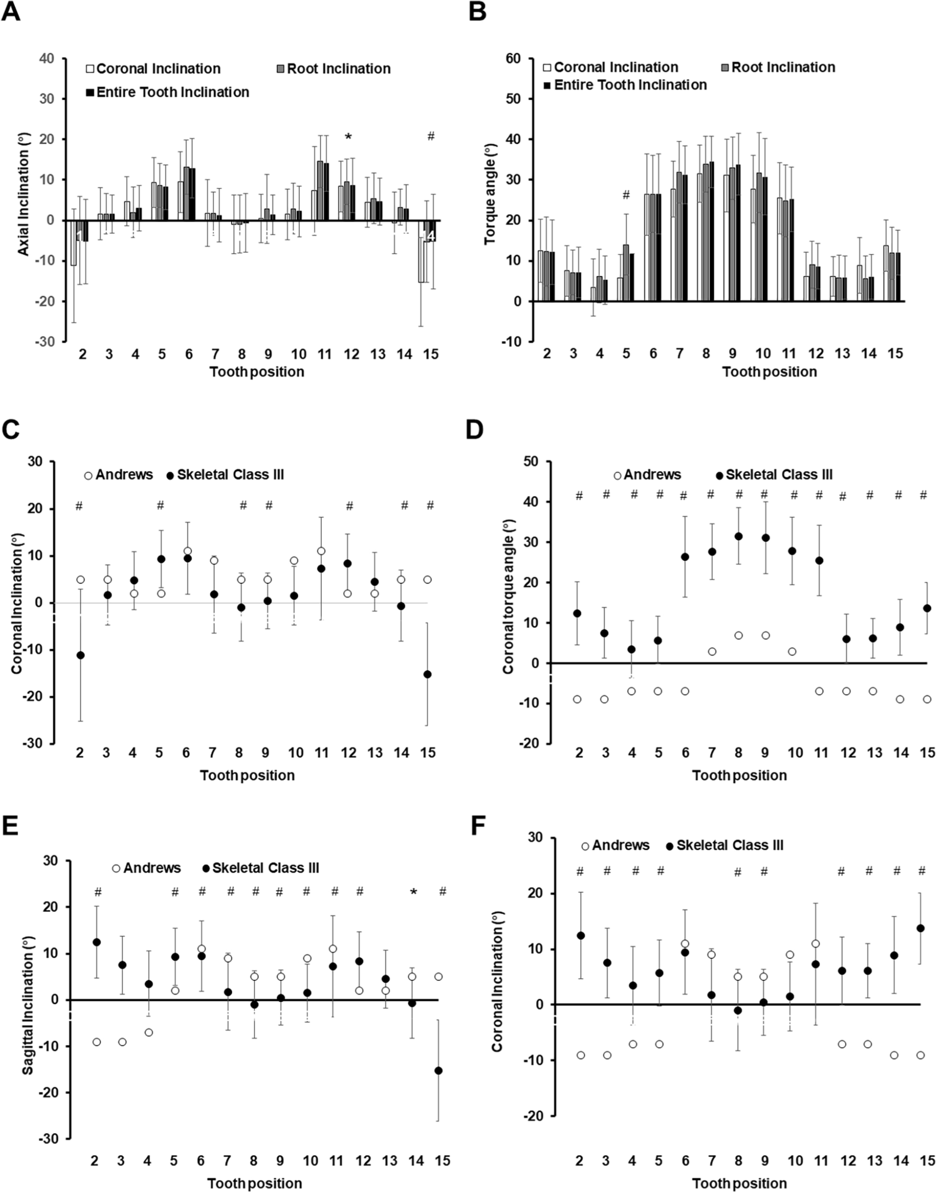 Figure 2 (A) Change in axial inclination of the maxillary tooth position for the skeletal class III malocclusion abnormality. (B) Change in torque angle of the maxillary tooth position for the skeletal class III malocclusion abnormality. (C) Comparison of the skeletal class III malocclusion with Andrew’s measurements for the maxillary coronal axial inclination. (D) Comparison of the skeletal class III malocclusion with Andrew’s measurements for the maxillary coronal torque angle. (E) Comparison between the skeletal class III malocclusion cases and the normal occlusion cases for sagittal inclination on the maxillary teeth. (F) Comparison between the skeletal class III malocclusion cases and the normal occlusion cases for the coronal inclination on the maxillary teeth.