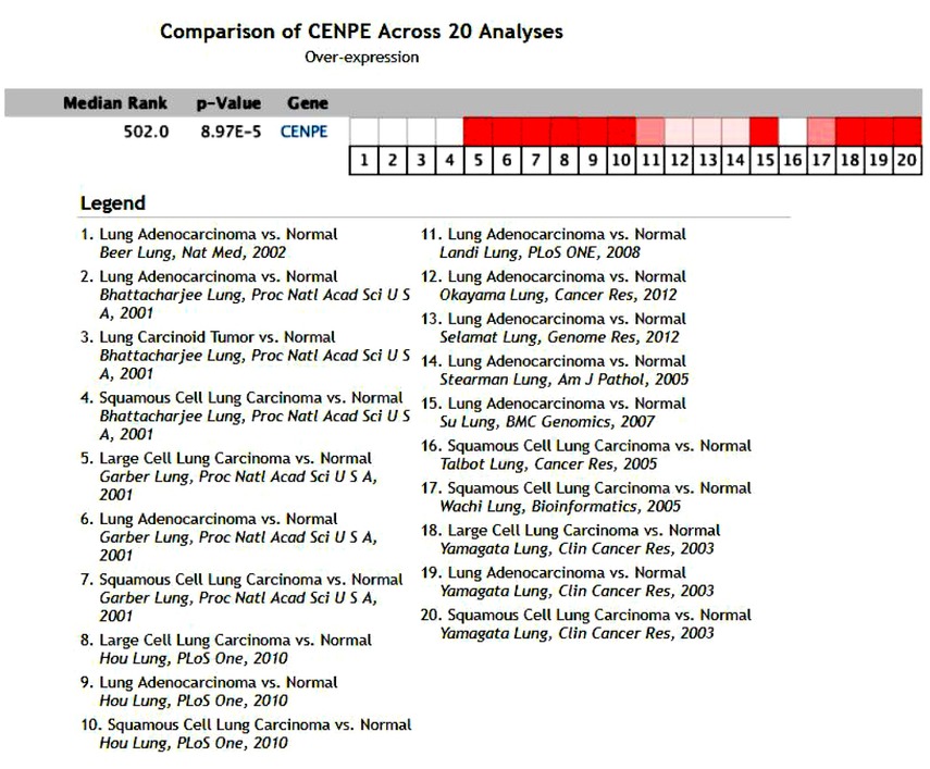 Figure 2 Expression of CENPE in NSCLC in the Oncomine database