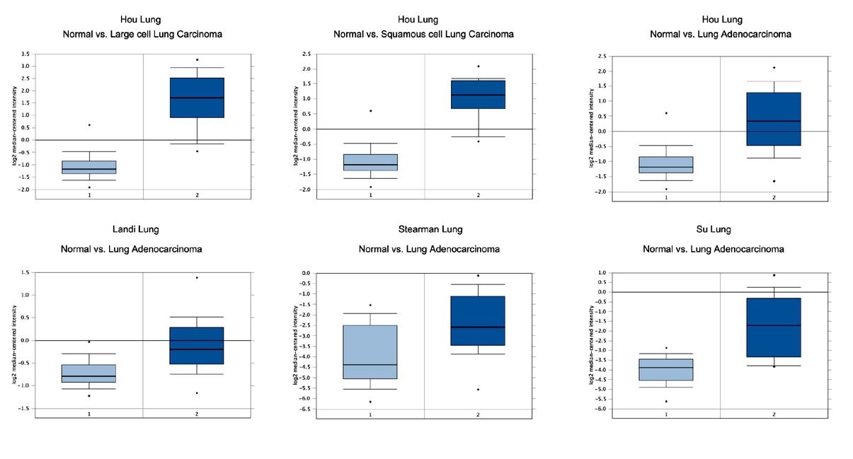 Figure 3 Differences in expression of CENPE in different NSCLC research arraies