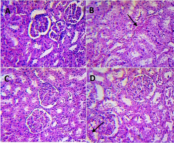 Figure 6 Kidneys in rats treated with a single IF dose (part B) and with five consecutive IF doses (part D) with appropriate control groups (part A and C, respectively). H&E staining, magnification 100x.